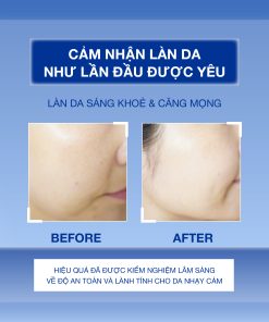 Tinh Chất Sáng Da Và Cải Thiện Nếp Nhăn Danique Retinol Midnight Intensive Serum 30ml