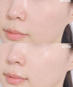 Mặt Nạ Dịu Da Khẩn Cấp 27g x 5 miếng – Cell Fusion C Post α First Cooling Mask