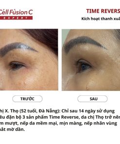 Tinh chất săn chắc da, hỗ trợ ngăn ngừa lão hóa 3in1 130ml – Cell Fusion C Expert Time Reverse Concentrate Essense