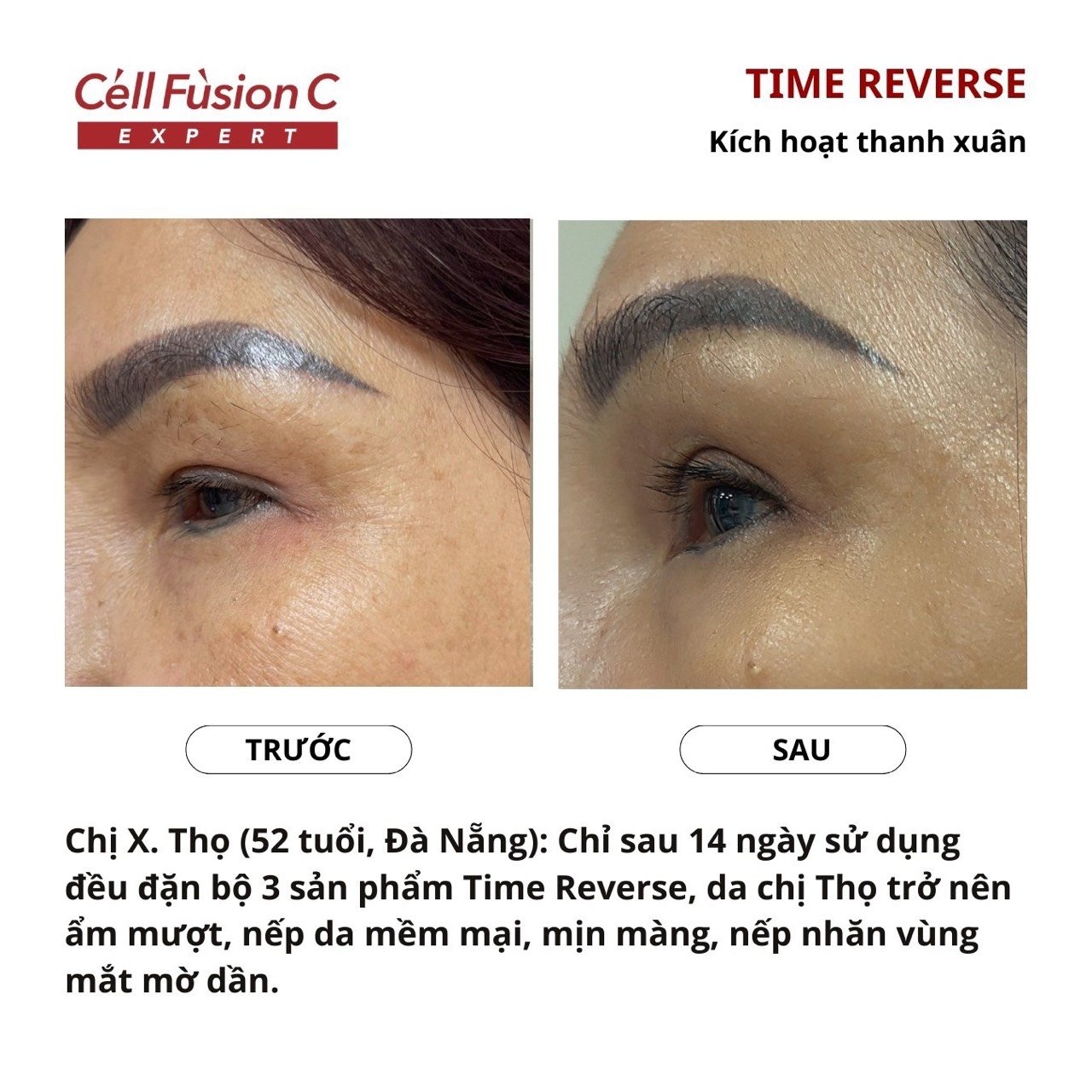 Tinh chất săn chắc da, hỗ trợ ngăn ngừa lão hóa 3in1 130ml – Cell Fusion C Expert Time Reverse Concentrate Essense