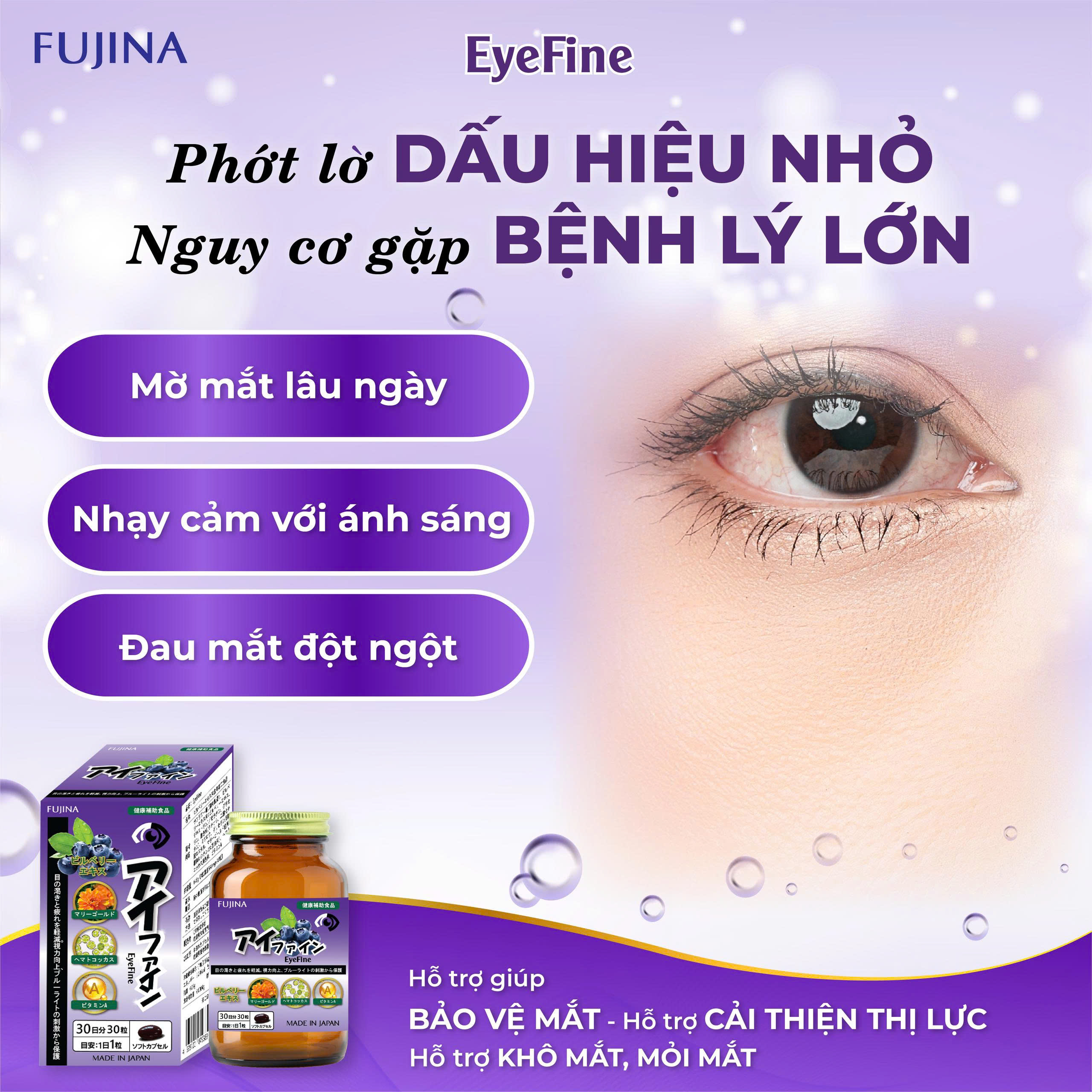 Viên Uống Bổ Mắt EyeFine Nhật Bản ( Hộp 30 viên )