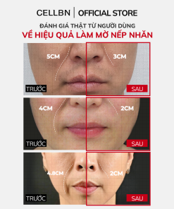 Combo giảm nếp nhăn và hỗ trợ cải thiện dấu hiệu lão hóa