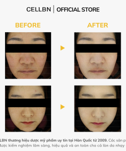 Serum Trắng Da Mờ Thâm Nám Glutathione 20.000ppm CELLBN hỗ trợ sáng da 30ml