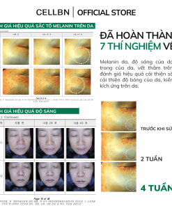 Set Hỗ Trợ Giảm Sắc Tố – Giảm Sạm Nám An Toàn – Kem Blemish Spot Cream & Gel Black Spot Patch