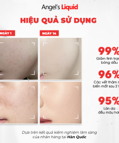Serum ANGEL’S LIQUID GLUTATHIONE PLUS NIACINAMIDE CICA AMPOULE hỗ trợ làm trắng, kiểm soát dầu & thu nhỏ lỗ chân lông (chai 45ml)