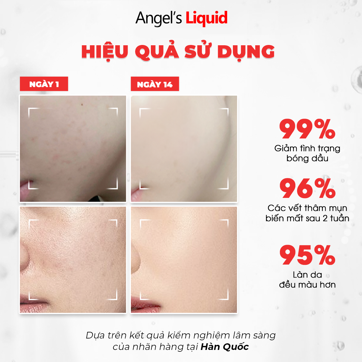 Serum ANGEL’S LIQUID GLUTATHIONE PLUS NIACINAMIDE CICA AMPOULE hỗ trợ làm trắng, kiểm soát dầu & thu nhỏ lỗ chân lông (chai 45ml)