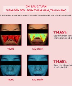 Serum ANGEL’S LIQUID TRANEXAMIC MELA ZERO AMPOULE hỗ trợ giảm thâm nám chuyên biệt (chai 30ml)