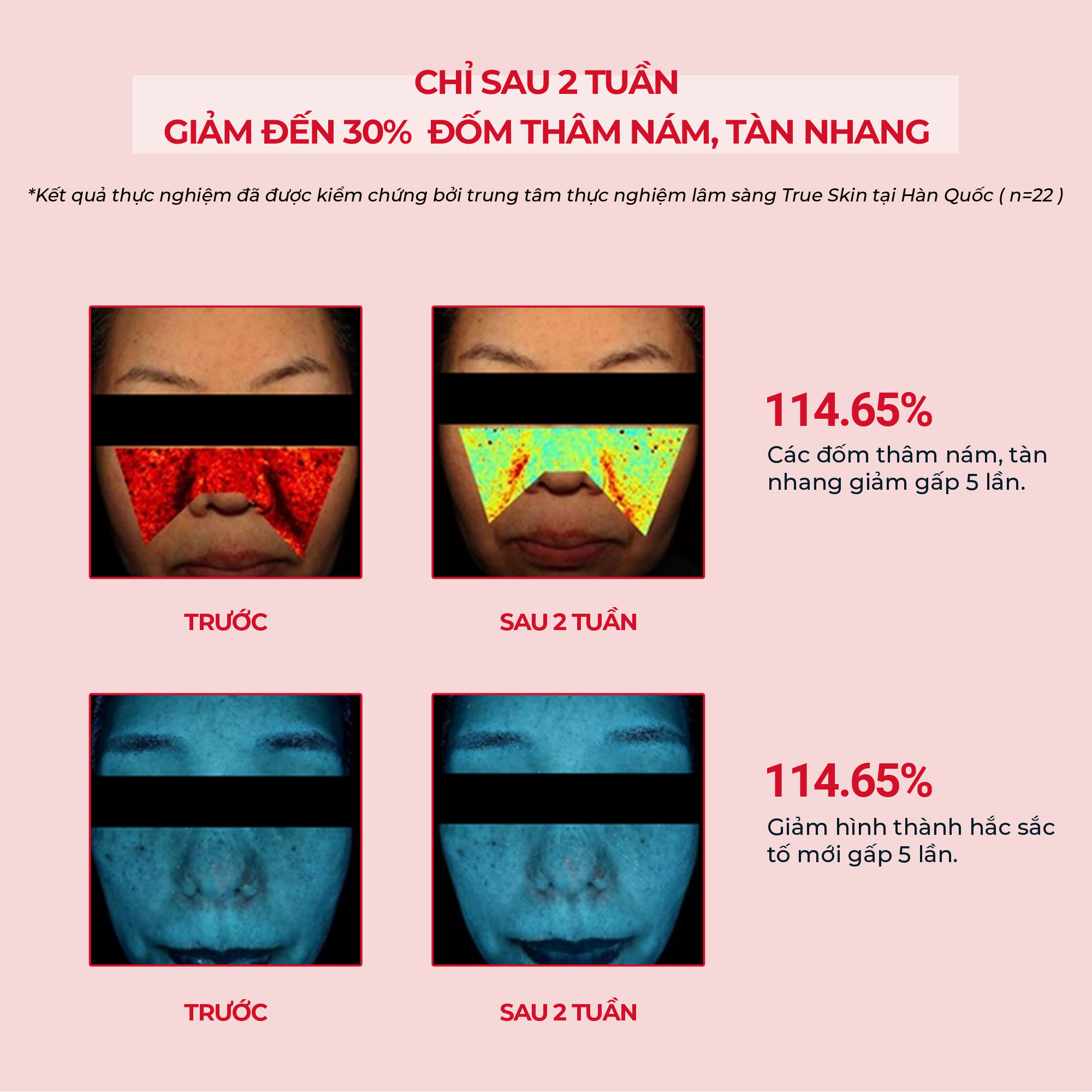 Serum ANGEL’S LIQUID TRANEXAMIC MELA ZERO AMPOULE hỗ trợ giảm thâm nám chuyên biệt (chai 30ml)