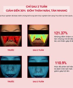 Toner acid ANGEL’S LIQUID TRANEXAMIC MELA ZERO hỗ trợ giảm thâm nám chuyên biệt (chai 150ml)