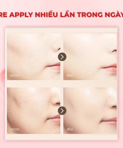 Sáp chống nắng dạng thỏi Re-apply cho mọi loại da Dermablock Mild Sun Stick SPF50+ PA++++ 16g