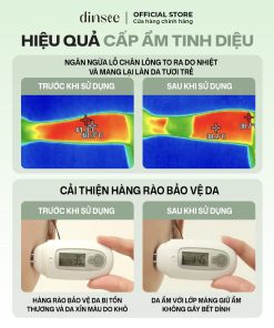 Kem Dưỡng Ẩm Thuần Chay Thiên Sơn Tuyết Liên – Dinsee Premium Vegan Snow Lotus Moisture Cream (50ml)